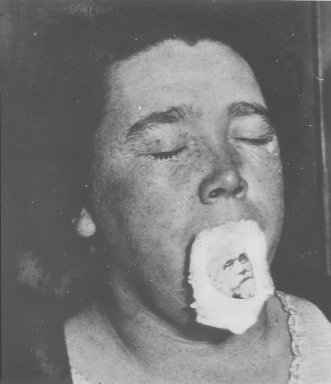 Helen Duncan with an image of a man attached to her mouth, eyes closed.