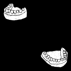 Black and white illustration of two dental molds of bottom teeth
